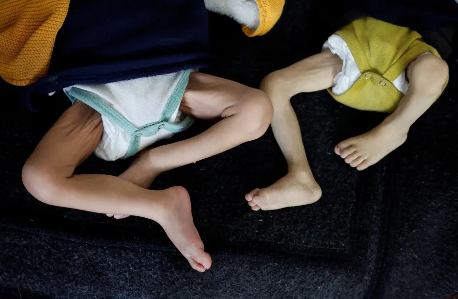 202404mena_palestine_gaza_starvation_children